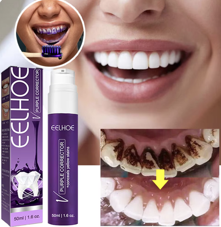 SONGQEE Purple Toothpaste,Teeth Whitening Toothpaste